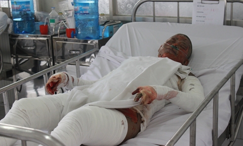 Tưới xăng thiêu người tình, kẻ ác nhân sẽ bị trừng trị - 1