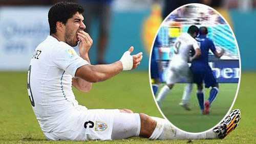 Rugby: Cấm thi đấu 1 năm vì 2 lần cắn đối thủ như Suarez - 1