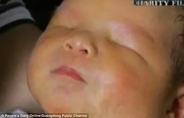 Em bé hoàn toàn không có mắt chào đời ở Trung Quốc - 1