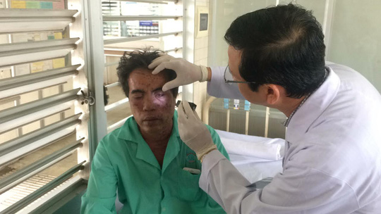 Lời kể kinh hoàng của 4 nạn nhân bị tạt a xít - 7