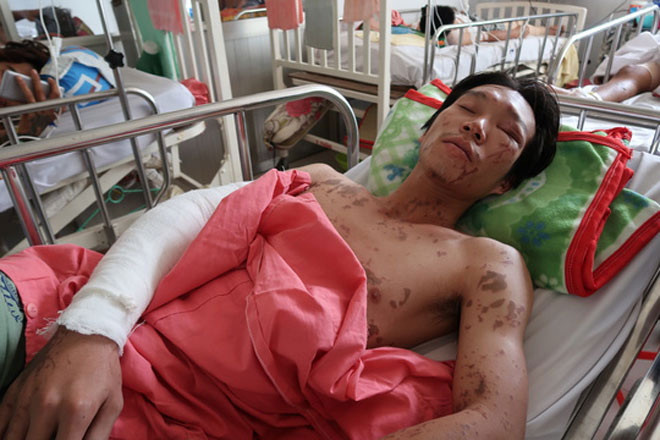 Lời kể kinh hoàng của 4 nạn nhân bị tạt a xít - 5