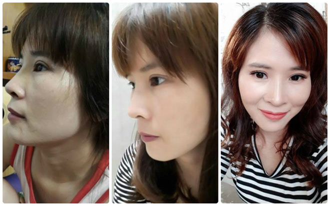 Bà mẹ "quê mùa" 3 con suýt ly hôn vì trốn chồng đi thẩm mỹ - 6