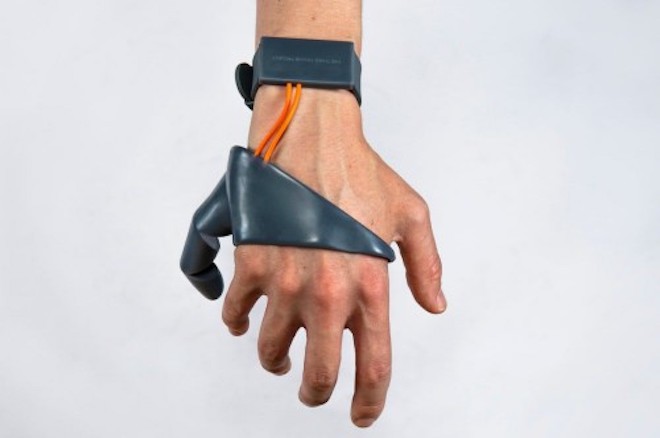 Công nghệ cho phép gắn thêm ngón tay nhân tạo để bàn tay có 6 ngón - 1