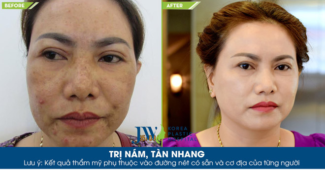 500 cơ hội làm đẹp không tốn phí tại miền Tây đang chờ bạn - 3