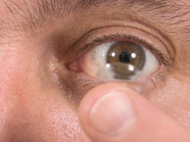 Khó tin: Để quên 27 kính áp tròng trong mắt