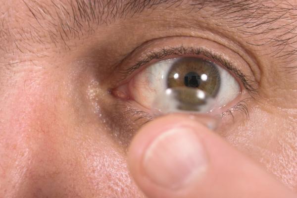 Khó tin: Để quên 27 kính áp tròng trong mắt - 1