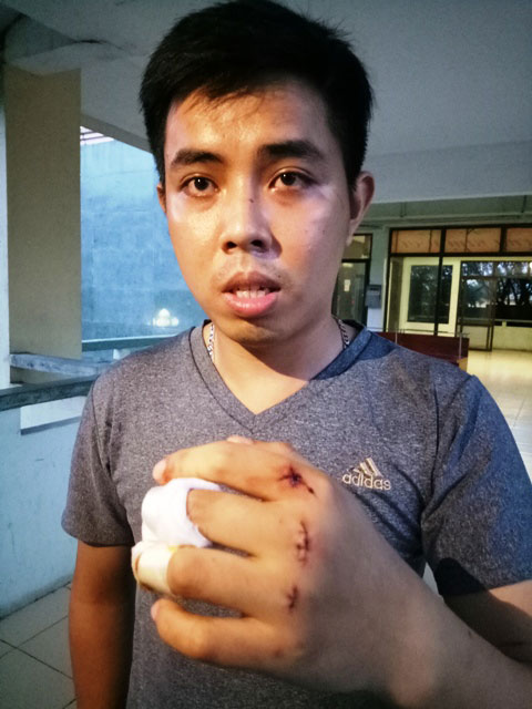 Mua nước chè không được, hung hãn vác dao chém 5 hàng xóm - 2