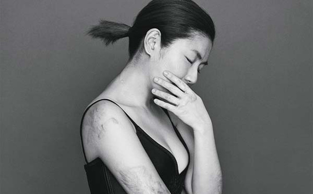 Ngọc nữ Đài Loan - đen tình đỏ vận sau vụ nổ phim trường 7 năm trước - 11