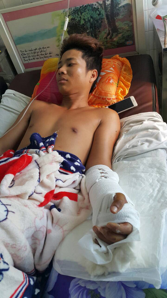 Sơ ý, một công nhân bị máy cắt giấy xén luôn bàn tay - 2