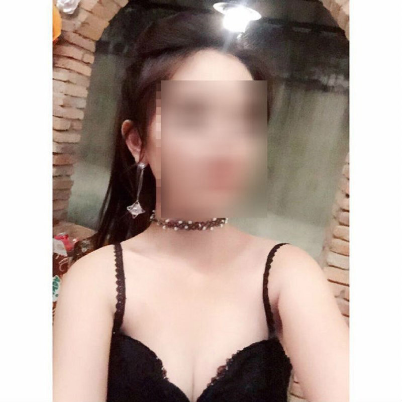 Thai phụ 22 tuổi tử vong sau khi nâng ngực 10 ngày - 1