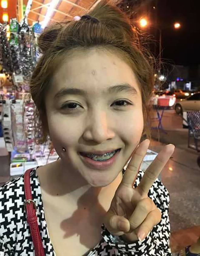 Thiếu nữ Thái đồng loạt đua nhau đi xỏ khuyên má - 4