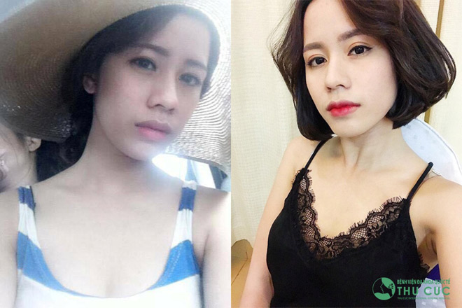Thẩm mỹ mắt, môi - combo giúp mọi cô gái trở nên quyến rũ - 1