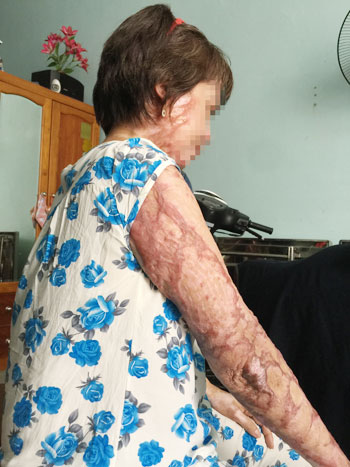 Đòn tình tàn độc - 2