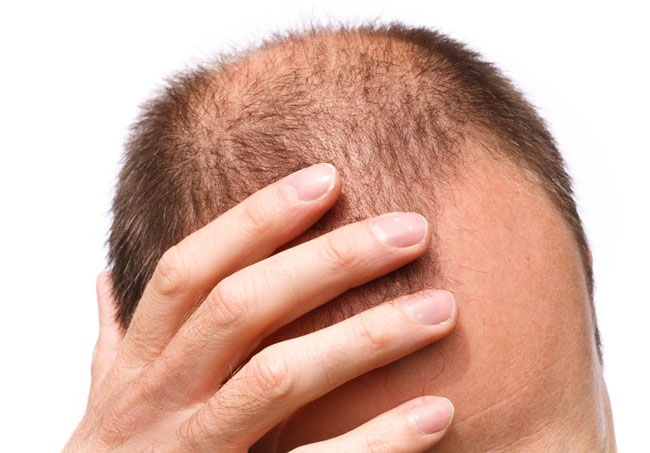 8 dấu hiệu dự báo cơn đau tim trước khoảng 1 tháng - 5