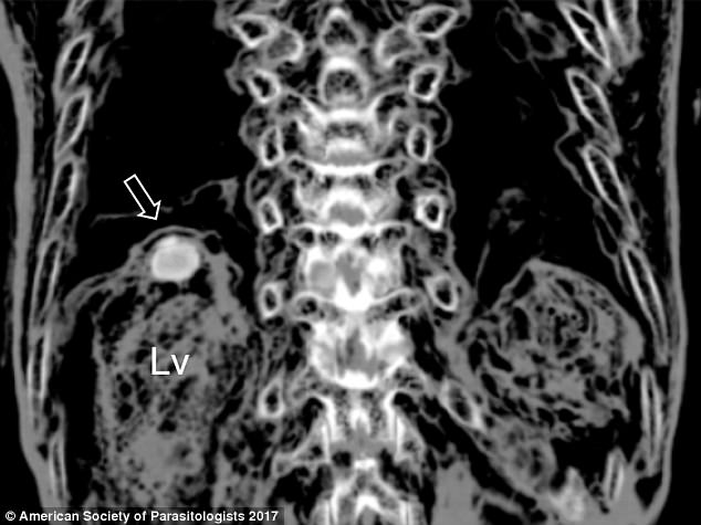 Hàn Quốc: Phát hiện trứng sán trong gan xác ướp 375 tuổi - 2