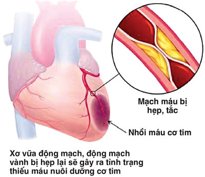 Mùa thu, những bệnh nào hay &#34;ghé thăm&#34; bạn? - 1