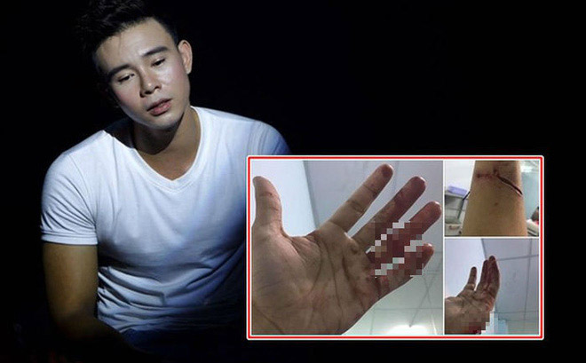 Lộ "đường sống" cho ca sĩ bị giang hồ chém vì món nợ tiền tỷ - 2