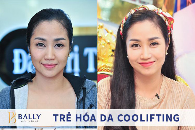 Chia sẻ phương pháp trẻ hóa da “ngon - bổ - rẻ” cho các mẹ bỉm sữa - 1