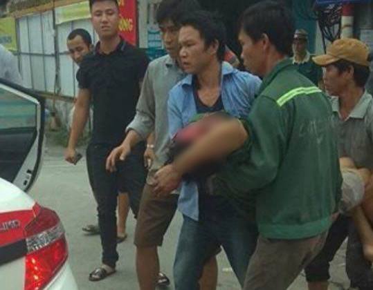 Hà Nội: Người đàn ông bị thương sau tiếng nổ lớn ở Xã Đàn - 1