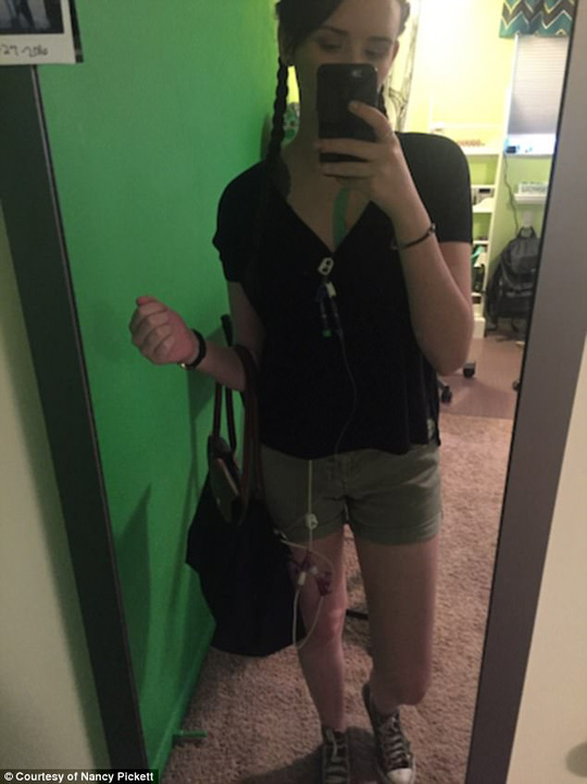 Câu chuyện kỳ diệu của cô gái mất khả năng ăn - 2