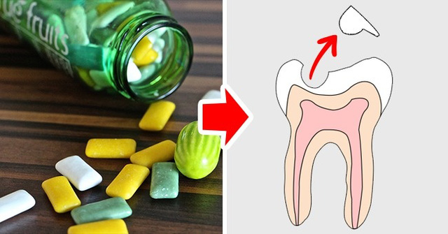 9 loại thực phẩm hay ăn hằng ngày có hại cho răng ít người biết - 5