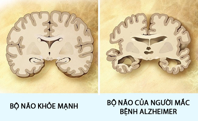 13 điều những người thông minh không bao giờ làm hằng ngày - 5