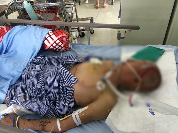 Bị chó tấn công, người đàn ông thiệt mạng sau 2 tháng bất tỉnh - 1