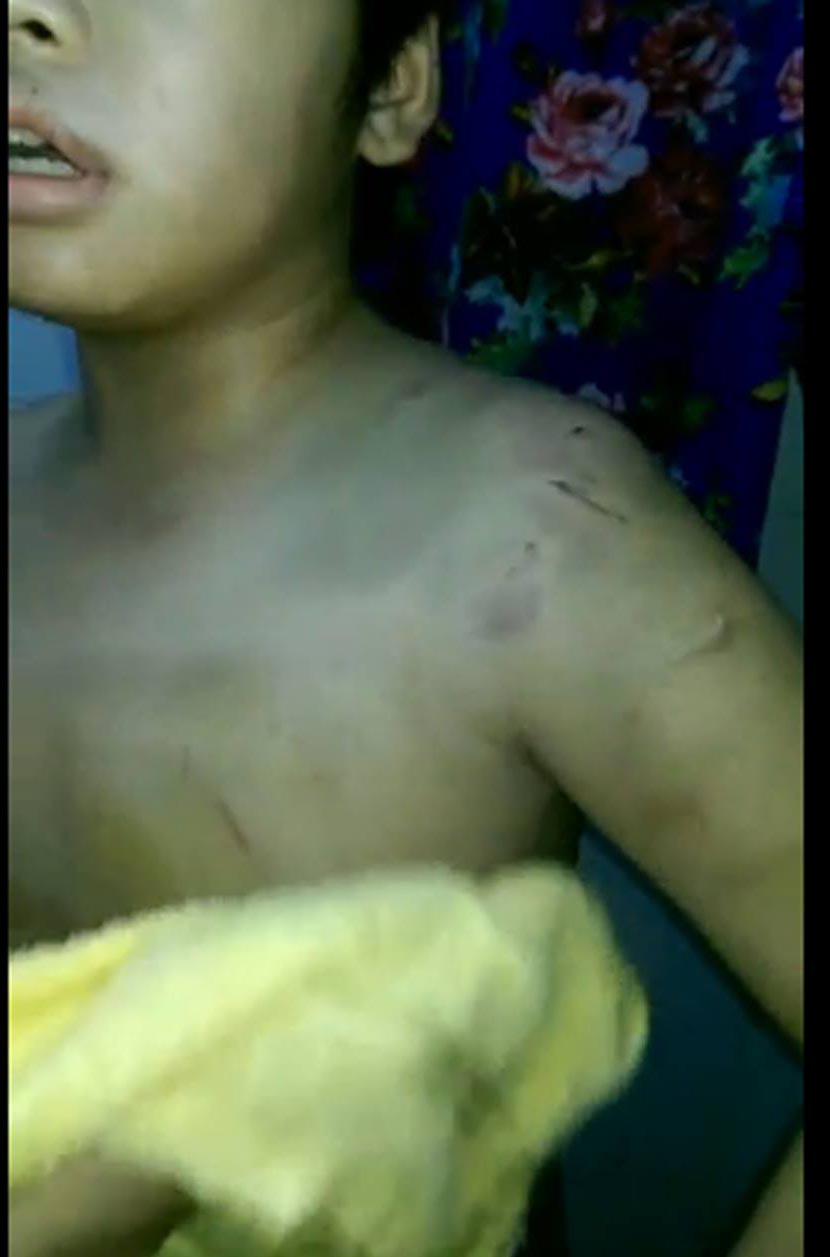 Bé trai 9 tuổi bị mẹ và dì bạo hành đến nhập viện - 1