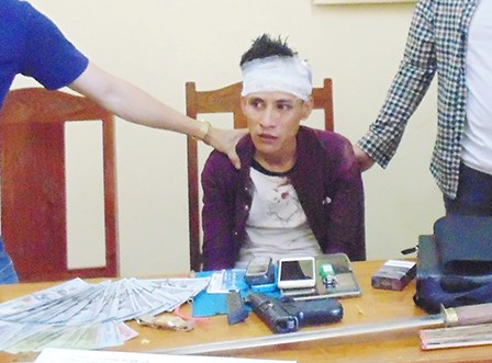 Nóng 24h qua: Chủ nói lý do chặt chân chó gây xôn xao mạng xã hội - 3