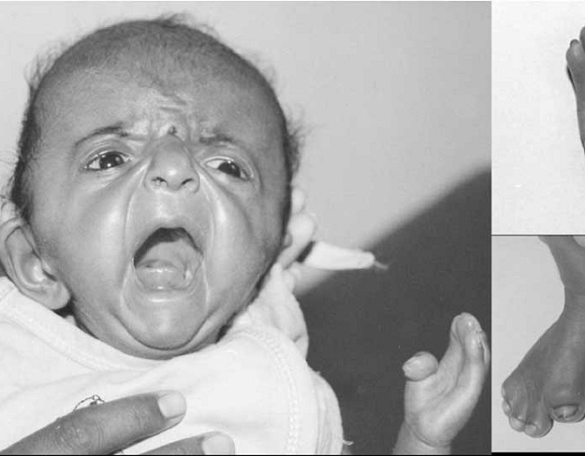 Căn bệnh hiếm và cái nắm tay định mệnh của cha con diễn viên Quốc Tuấn - 2