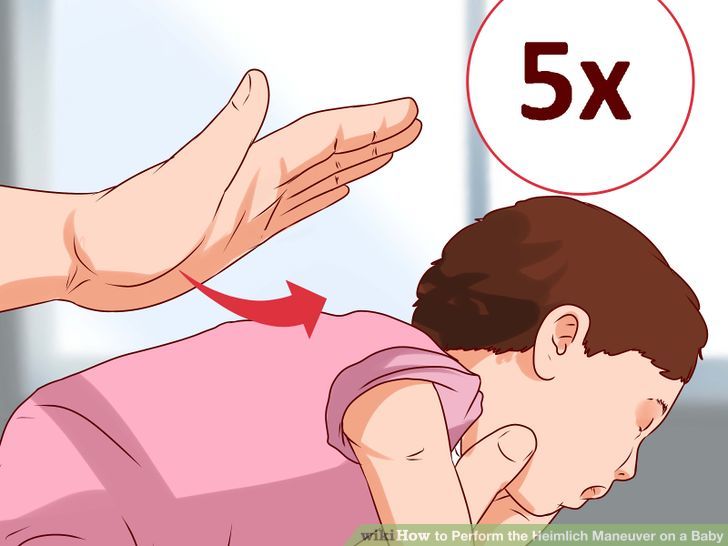 2 trẻ tử vong do sặc cháo, sữa: Cha mẹ biết điều này sẽ cứu được con - 2