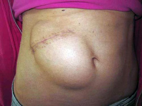 Hoa hậu có 1/4 hộp sọ trong bụng - 1