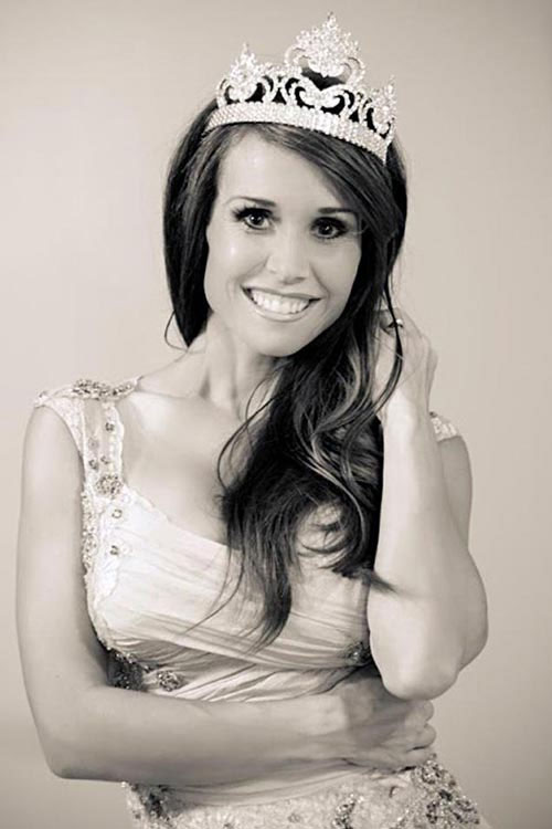 Hoa hậu có 1/4 hộp sọ trong bụng - 3