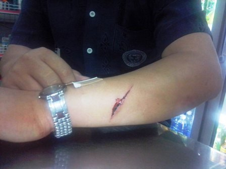 Mua hàng bằng... CMTND rồi đánh đập chủ quán - 1