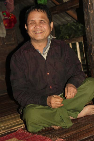 Kỳ diệu người đàn ông có “con mắt thứ 3” - 3