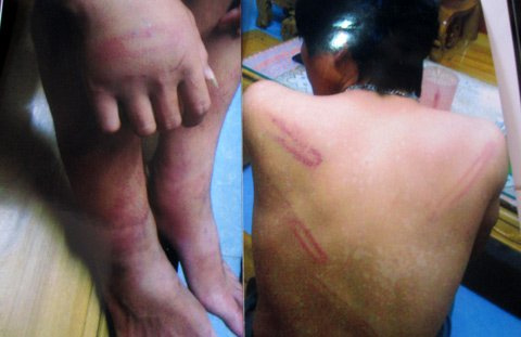 Tiếp vụ 7 thanh niên tố bị CA tra tấn - 2