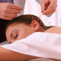 Sức khỏe đời sống - 6 lợi ích tuyệt vời từ châm cứu