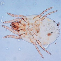 Sức khỏe đời sống - Bắt bọ ve làm ổ trong tai cụ ông 70 tuổi