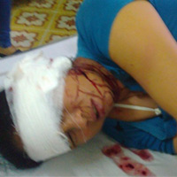 Pháp luật - Chém đứt tai vợ, còn dọa "xử" chồng