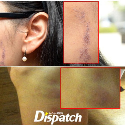 Bạo lực, cưỡng hiếp: Sao Hàn mất mặt - 2