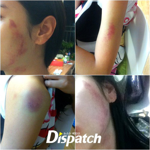 Bạo lực, cưỡng hiếp: Sao Hàn mất mặt - 3