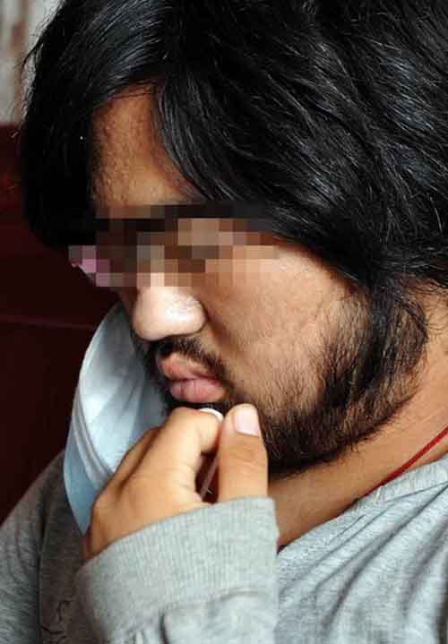 Cô bé 16 tuổi lông tóc mọc như đàn ông - 2