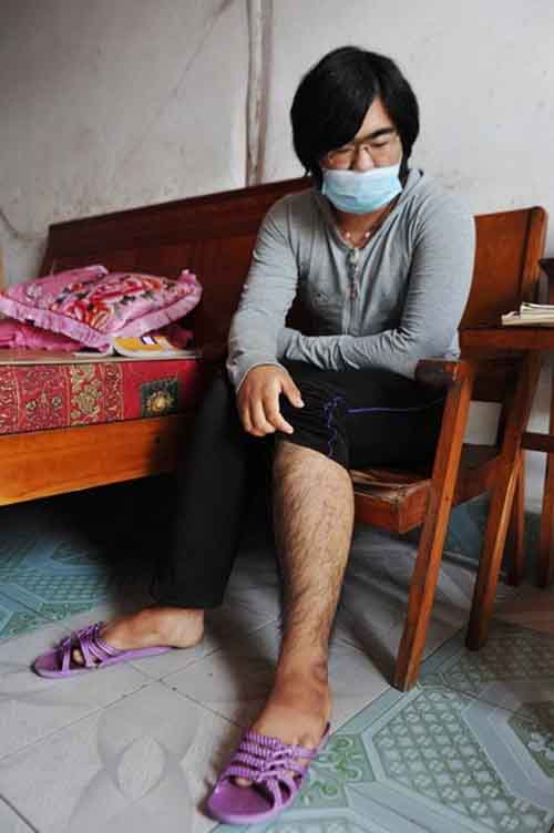 Cô bé 16 tuổi lông tóc mọc như đàn ông - 5