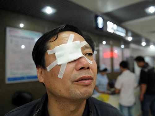 TQ: Bắn pháo hoa, hơn 150 người nhập viện - 2