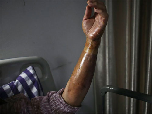 TQ: Bắn pháo hoa, hơn 150 người nhập viện - 7