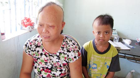 Gặp gia đình bị sét đánh ở Đà Nẵng - 1