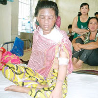 Pháp luật - Tin tiếp vụ chồng dội nồi nước sôi vào vợ