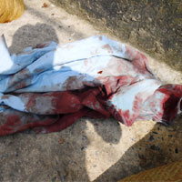 Pháp luật - Côn đồ chém đứt gân tay võ sĩ boxing