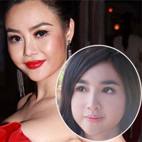 Thẩm mỹ viện - Lộ "thủ phạm" làm khuôn mặt sao sưng vù?