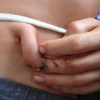 Phi thường - kỳ quặc - 5 ca phẫu thuật hiếm gặp nhất